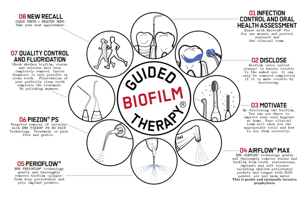 EMS Guided Biofilm Therapy 8 step protocol